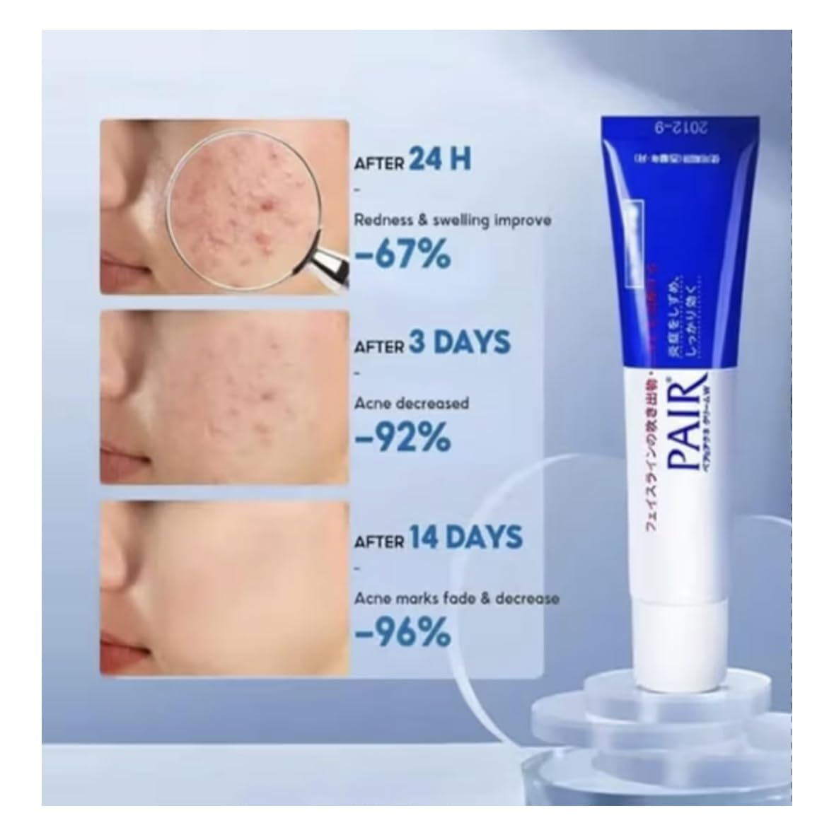 PAIR Acne Treatment Cream label detail showing Japanese medicated formula information