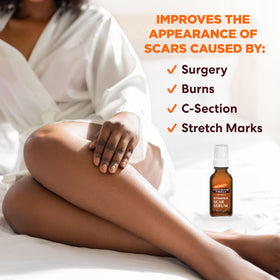Palmer's serum held in hand to show lightweight texture and absorption