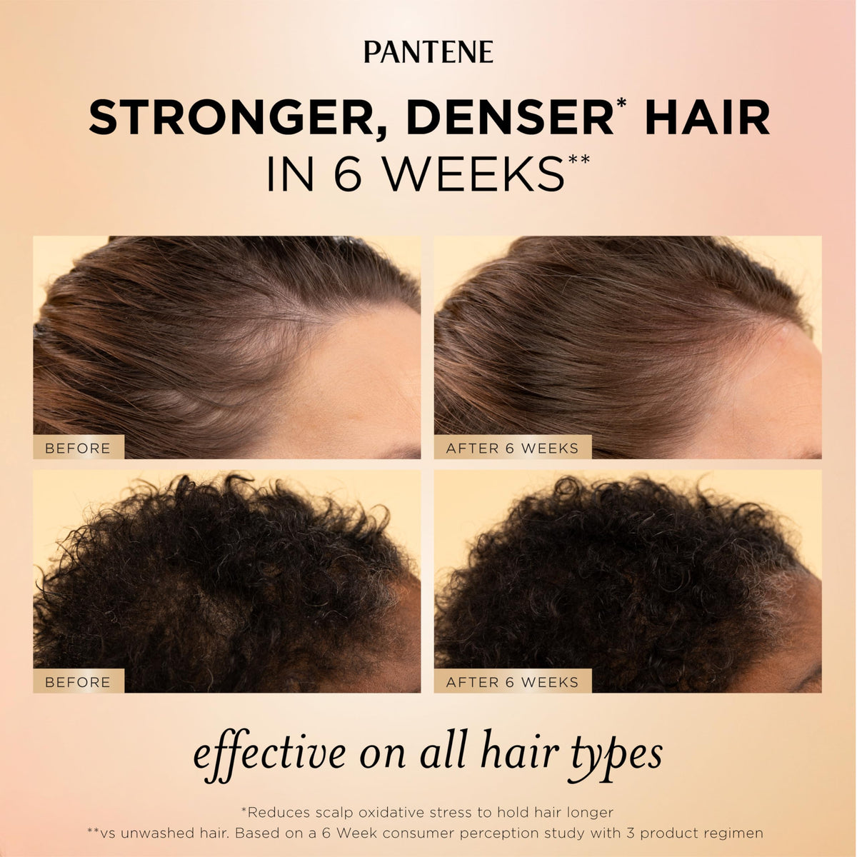 Pantene serum dropper dispensing product for targeted scalp care
