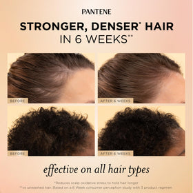 Pantene serum dropper dispensing product for targeted scalp care