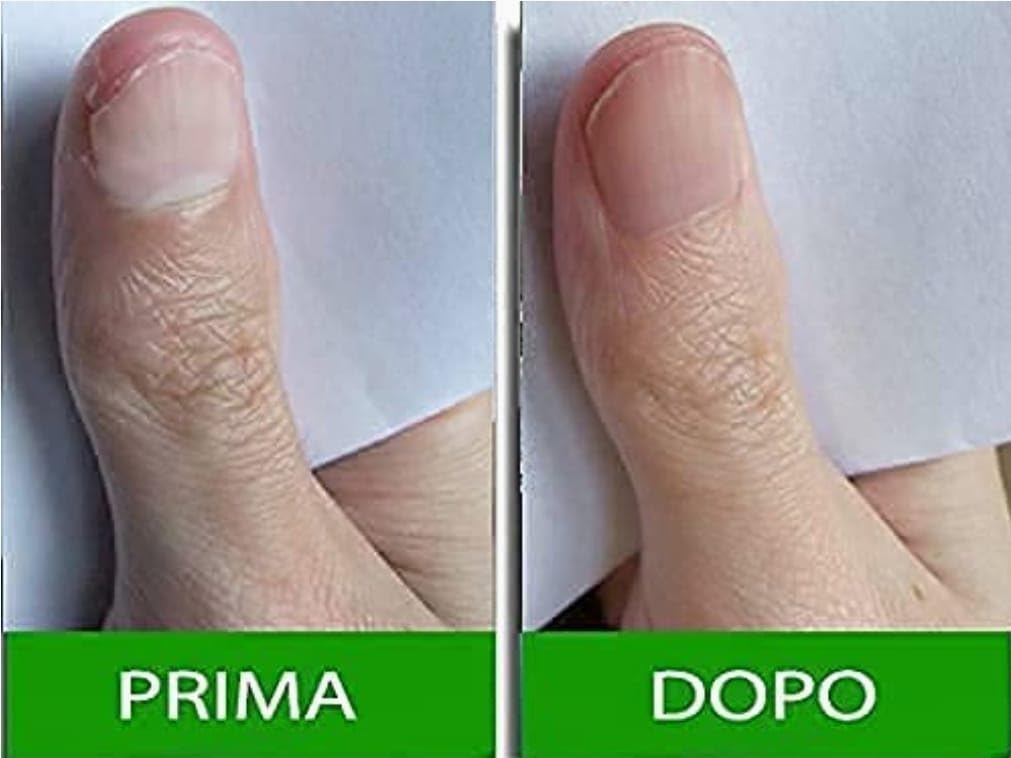 Hand holding Pantogar box illustrating compact one-month supply and portability
