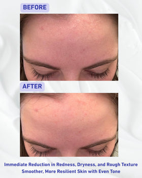 Pash Skin Protection applied on face illustrating soothing cooling relief