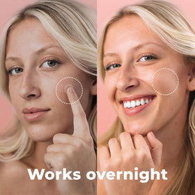 PatchRx applied on cheek illustrating how the patch conceals and protects blemishes