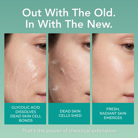 PatchRx ingredients label close-up highlighting hydrating actives