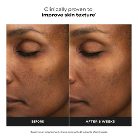 Paula's Choice applied on hand to show thin liquid consistency and control