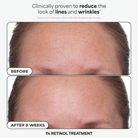 Paula's Choice 10% Azelaic Acid Booster pouring a drop to show blendable serum benefit