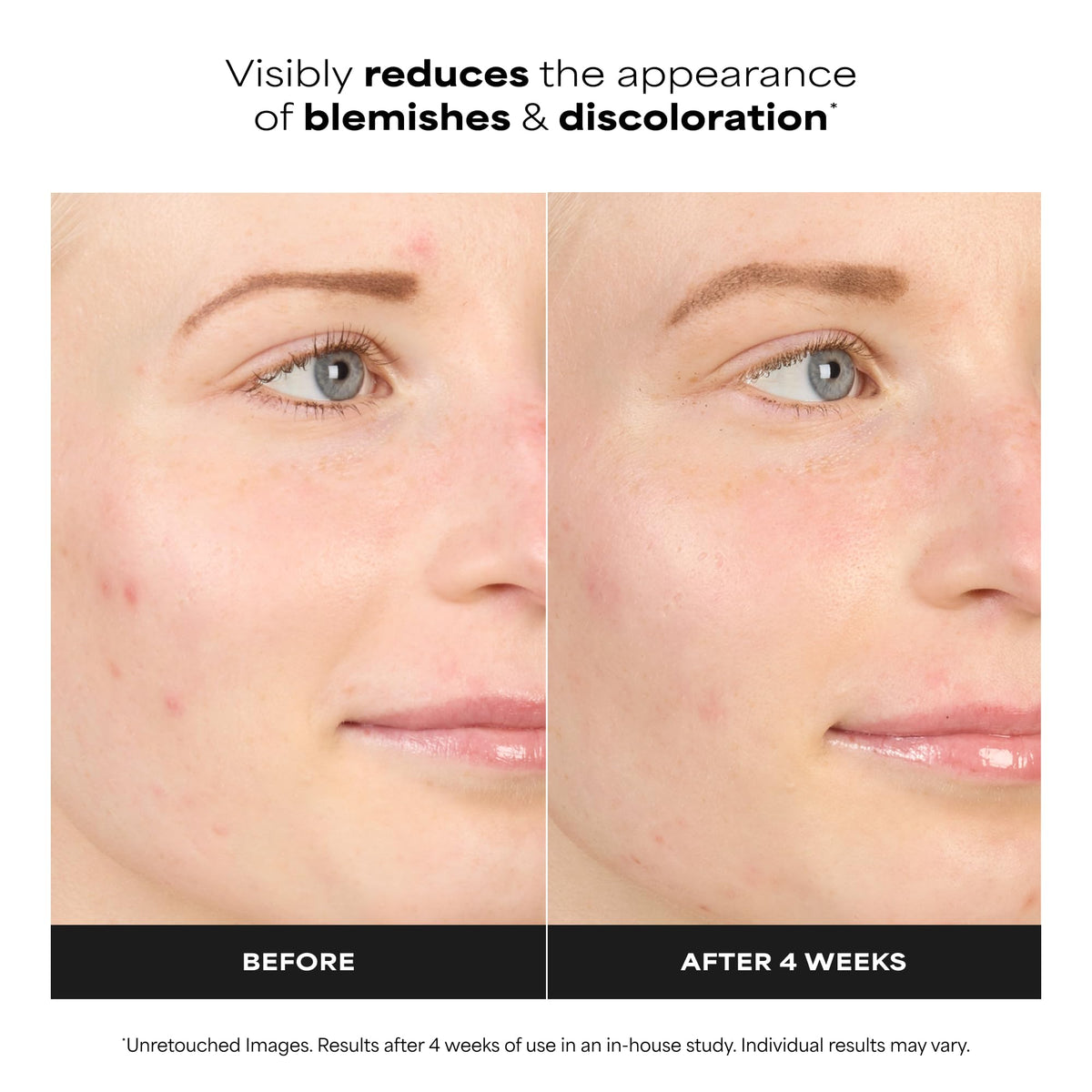 Paula's Choice dropper releasing serum demonstrating easy application