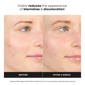 Paula's Choice dropper releasing serum demonstrating easy application