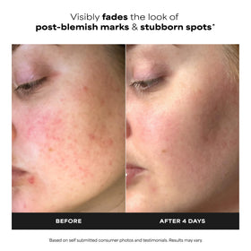 Paula's Choice gel texture close-up highlighting lightweight absorbency