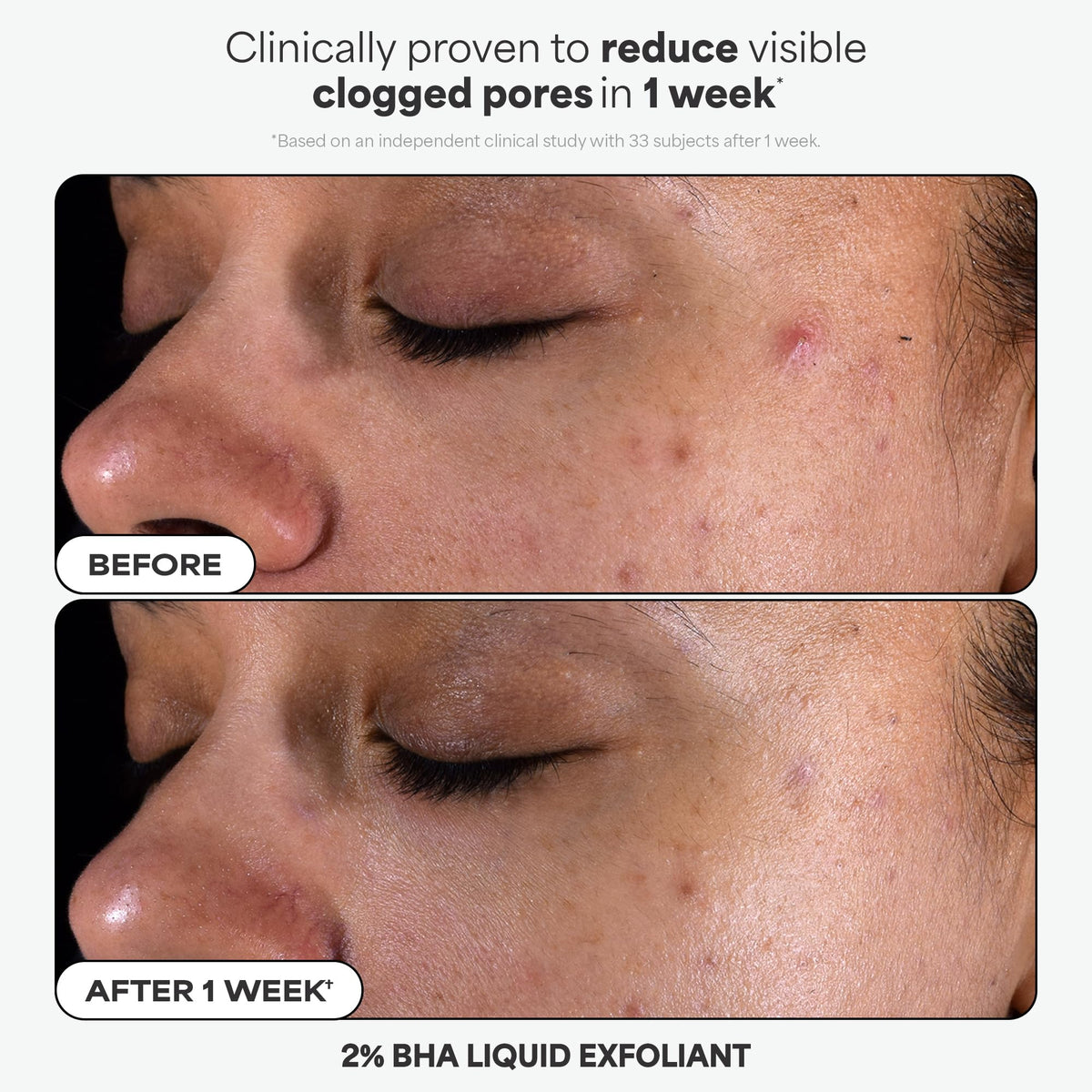 Paula's Choice 2% BHA Liquid Exfoliant close-up showing texture and applicator benefits