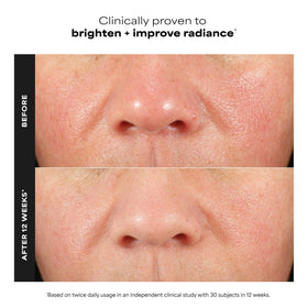 Paula's Choice dropper applying booster showing targeted antioxidant benefit