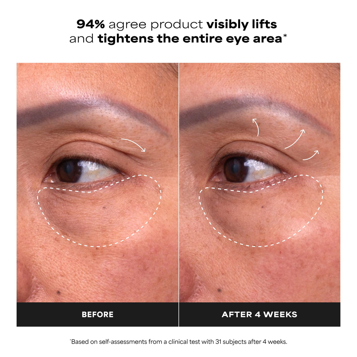 Paula's Choice cooling applicator close-up delivering instant soothing sensation
