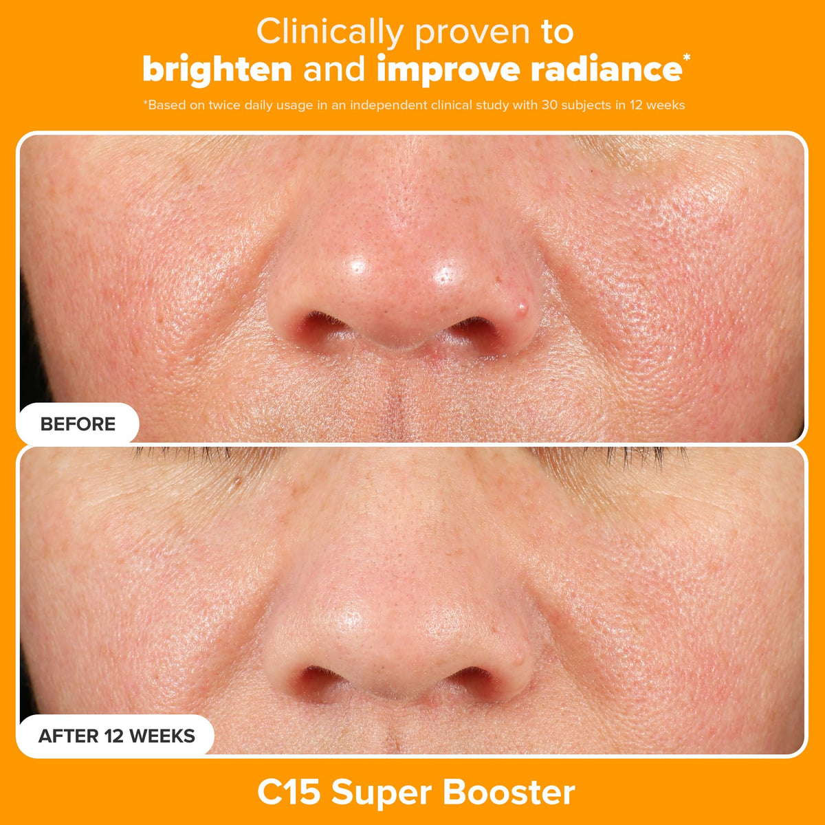 Paula's Choice mandelic acid exfoliant texture close-up for gentle resurfacing