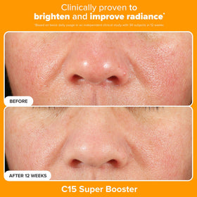 Paula's Choice mandelic acid exfoliant texture close-up for gentle resurfacing