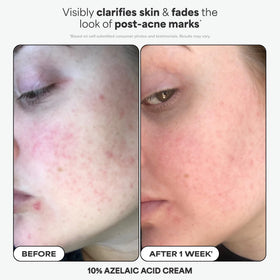 Paula's Choice 1% Retinol Treatment dropper detail highlighting controlled application benefit