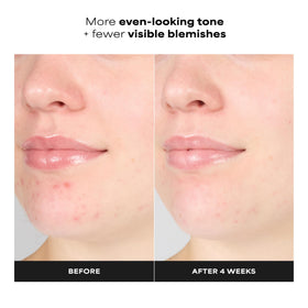 Paula's Choice gel texture close-up showing lightweight consistency and spreadability