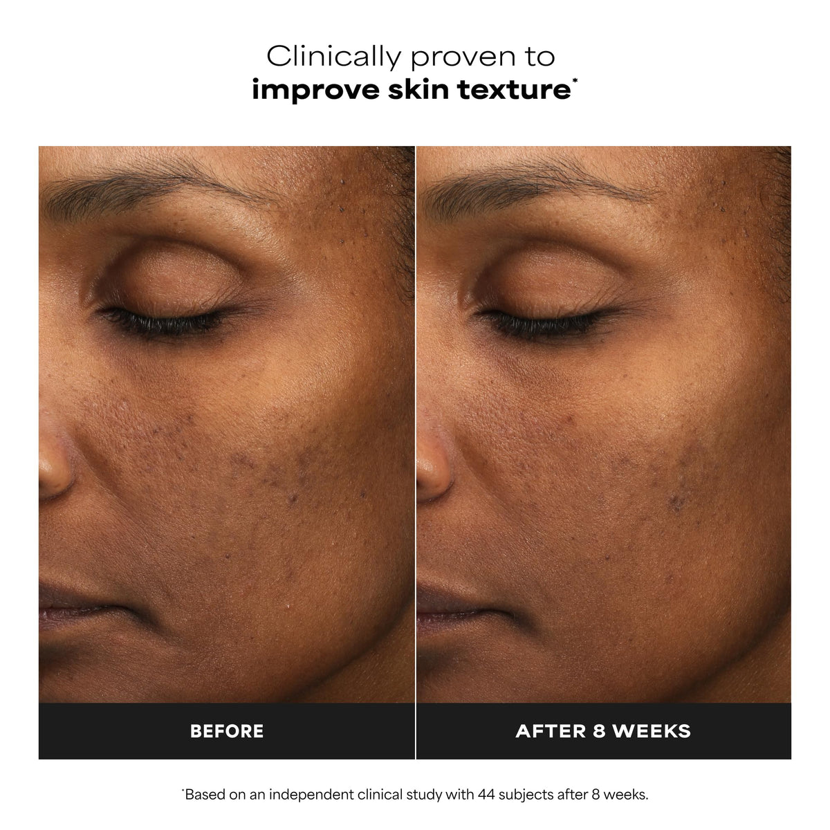 Paula's Choice liquid texture on skin demonstrating lightweight absorption