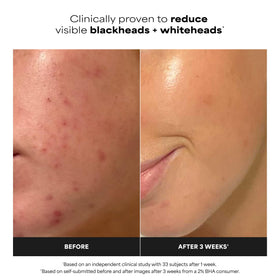 Paula's Choice pad texture and soaked solution highlighting gentle exfoliation