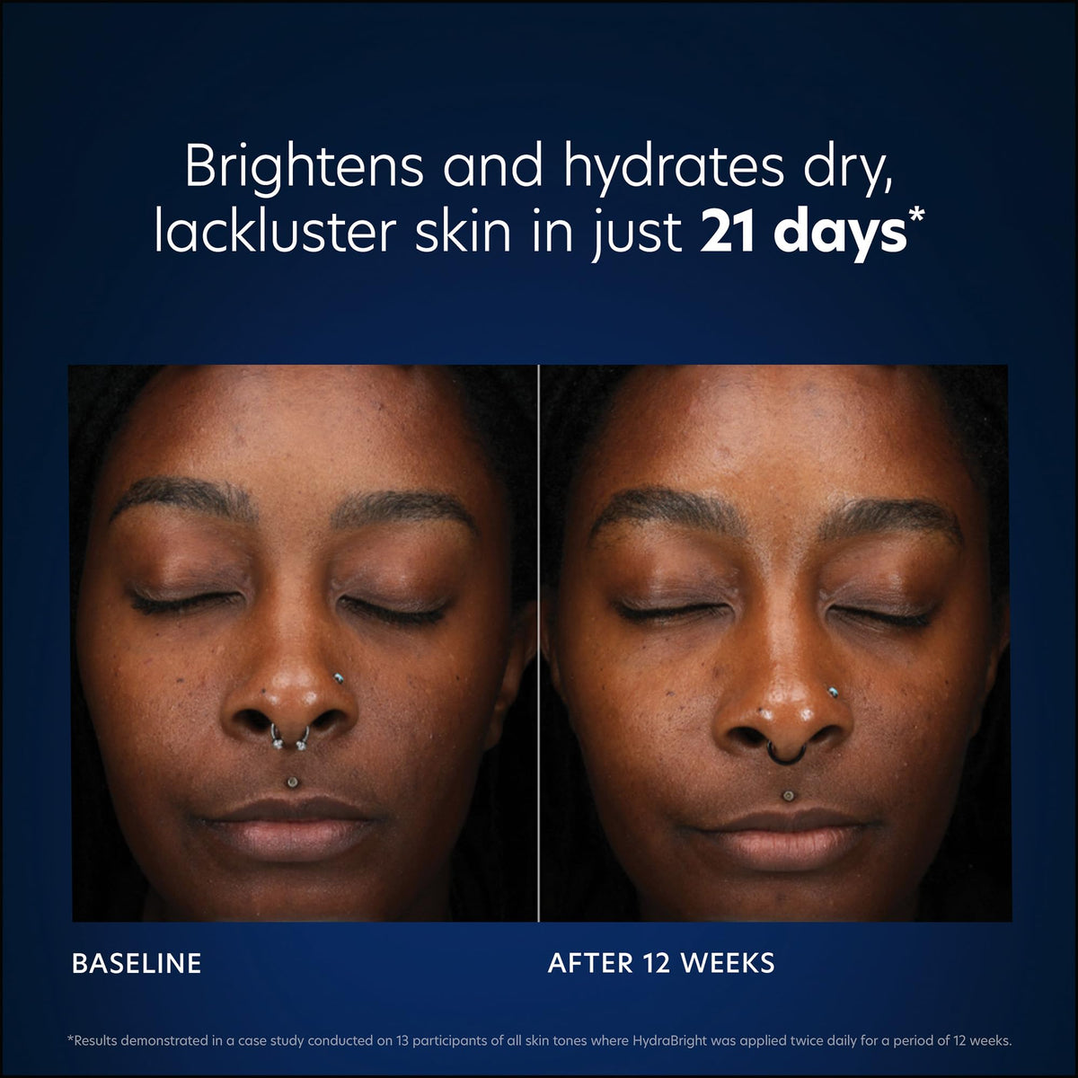 PCA SKIN niacinamide ingredient depiction indicating tone-evening benefit