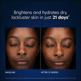 PCA SKIN niacinamide ingredient depiction indicating tone-evening benefit