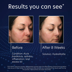 PCA SKIN HydraMatte with Rosa Centifolia flower highlighting smoothing benefit