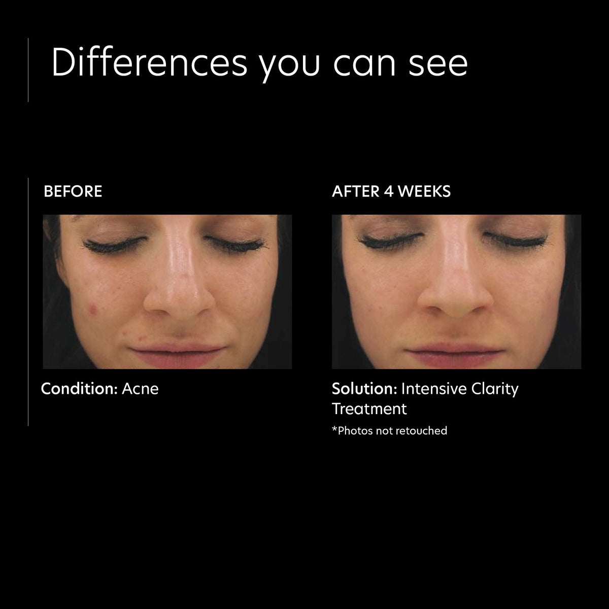 PCA SKIN ingredients label showing retinol and salicylic acid benefits
