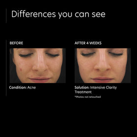 PCA SKIN ingredients label showing retinol and salicylic acid benefits