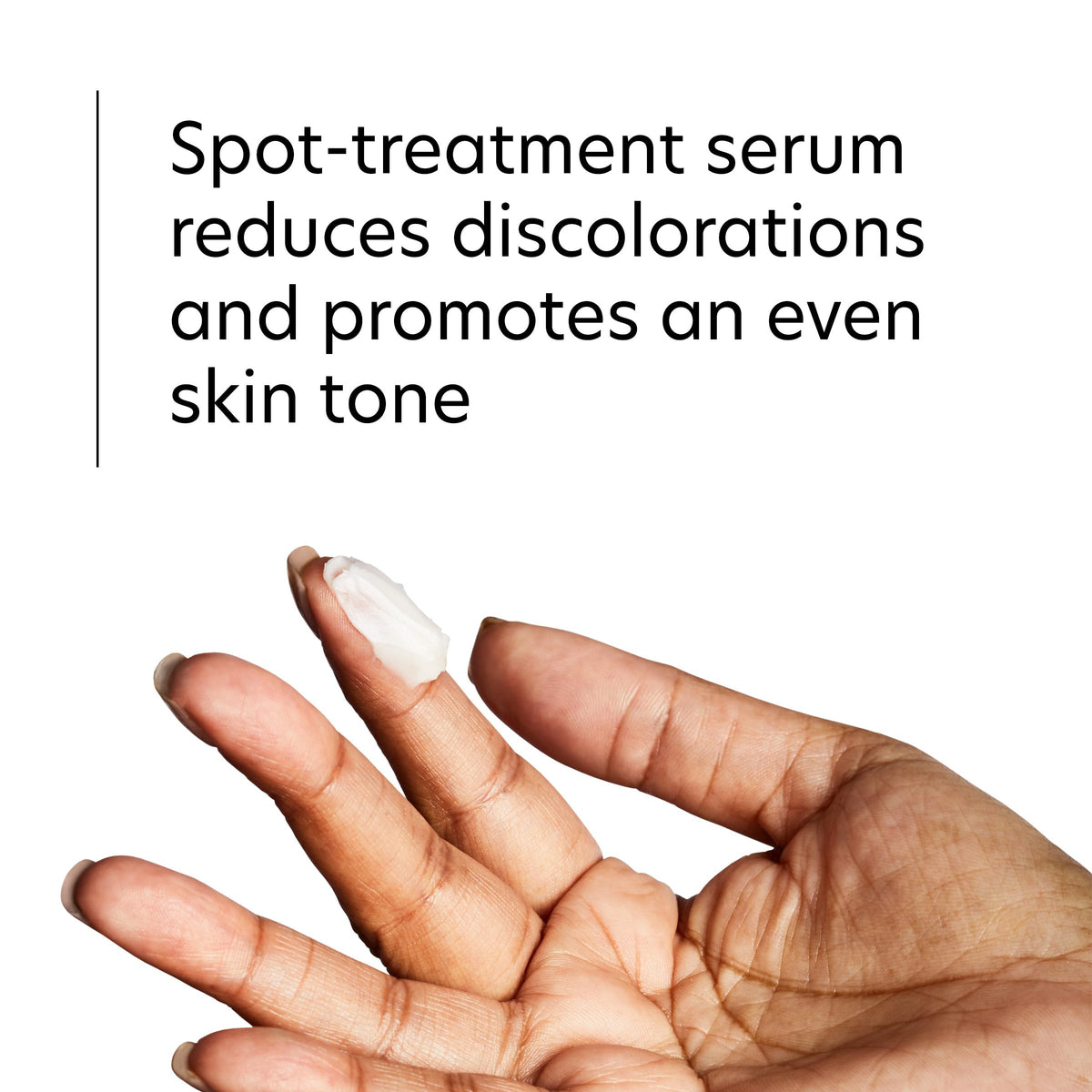 PCA SKIN gel on fingertip ready to apply for precise spot treatment