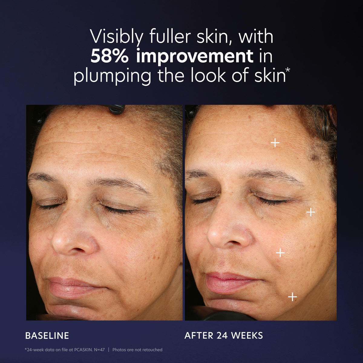 PCA SKIN before and after schematic illustrating improved firmness visually