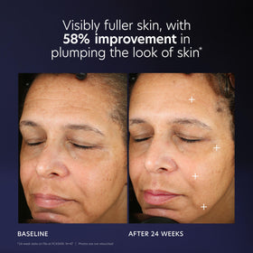 PCA SKIN before and after schematic illustrating improved firmness visually