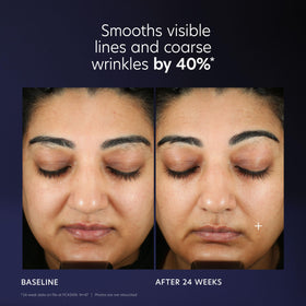 PCA SKIN lifestyle model applying serum with visible smoother skin effect