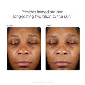 PCA SKIN serum absorbing into skin detail showing fast non-greasy finish