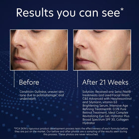 PCA SKIN application on hand showing quick spread and skin compatibility benefit