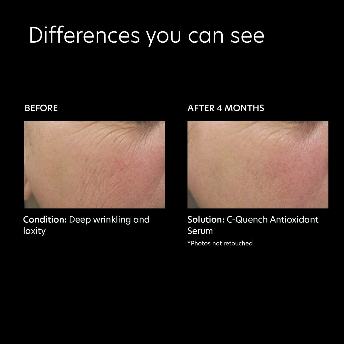PCA SKIN ingredient label highlighting vitamin C, lilac stem cell and hyaluronic acid