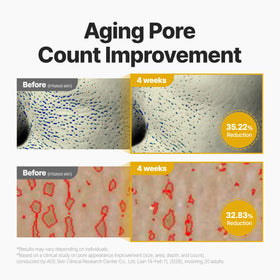P.CALM cream applied on hand demonstrating spreadability and quick absorption