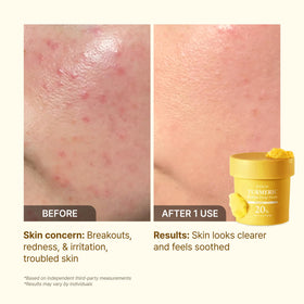 P.CALM label showing key ingredients and gentle formulation