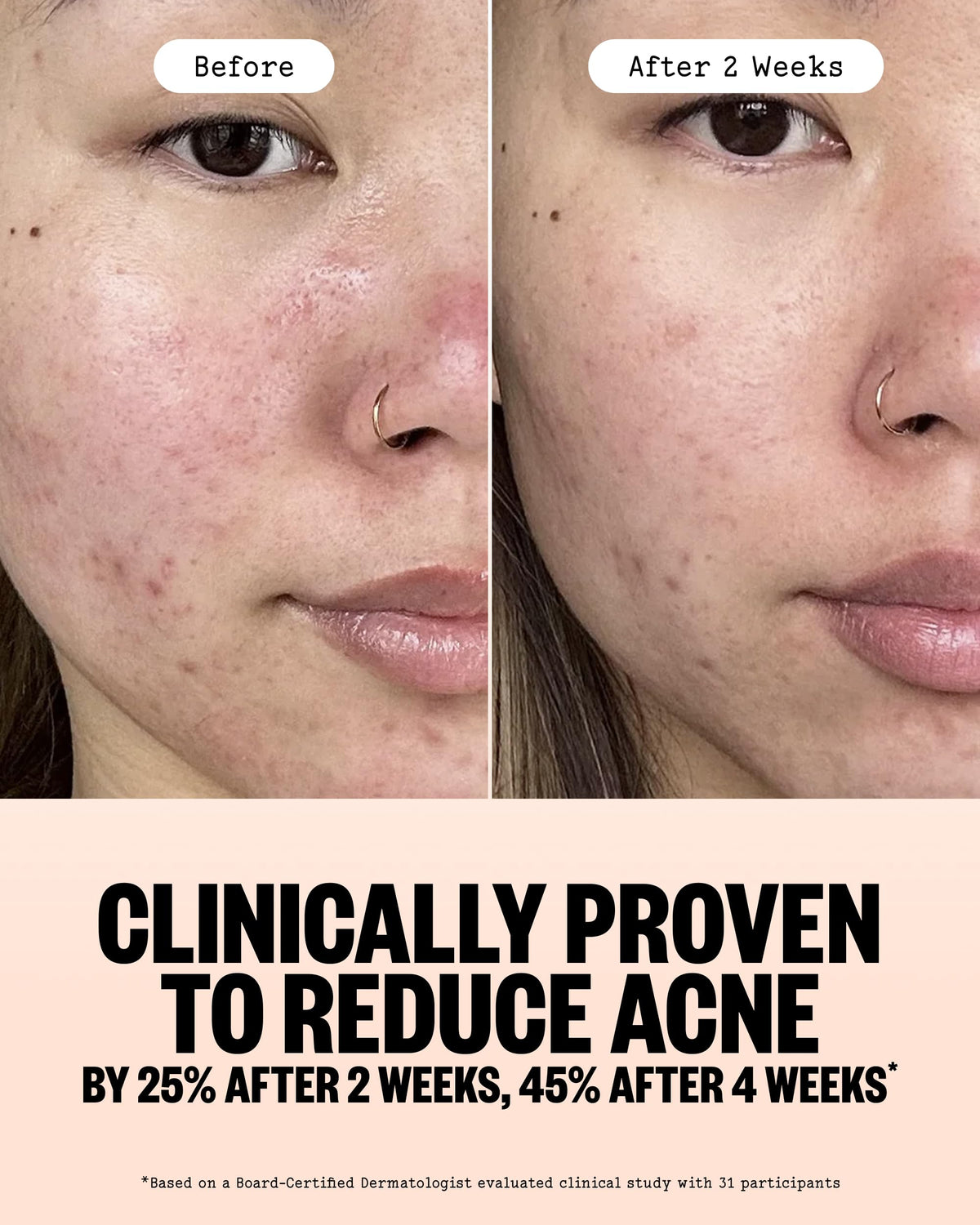 PEACE OUT label close-up highlighting 2% salicylic acid for pore-clearing