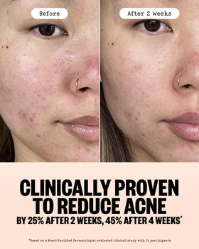 PEACE OUT label close-up highlighting 2% salicylic acid for pore-clearing