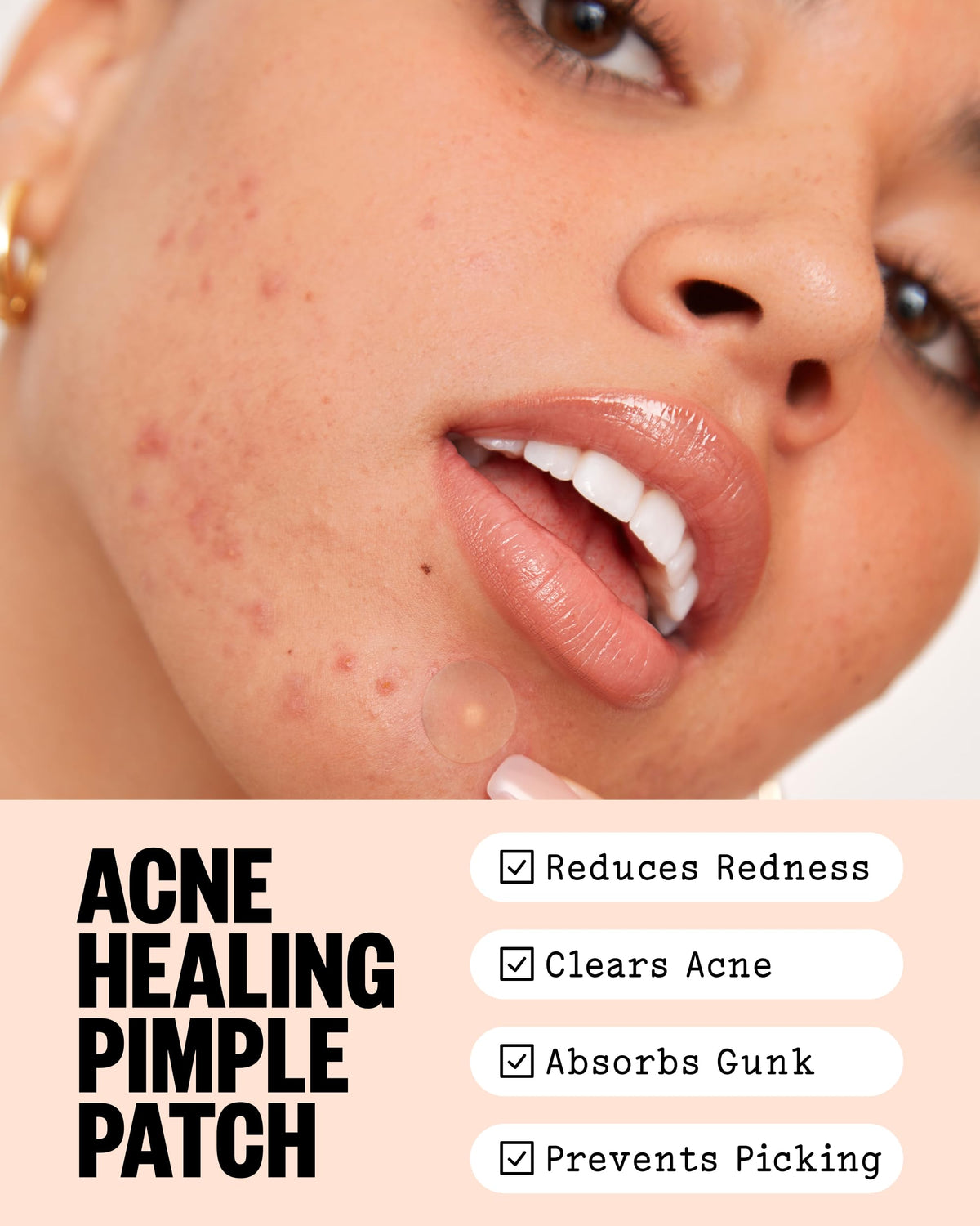 PEACE OUT close-up of patch texture highlighting thin hydrocolloid adhesion benefit