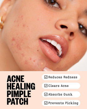 PEACE OUT single acne dot close-up showing thin edge and hygienic backing for easy use