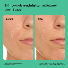 Peach Slices in bathroom routine indicating gentle daily use benefit