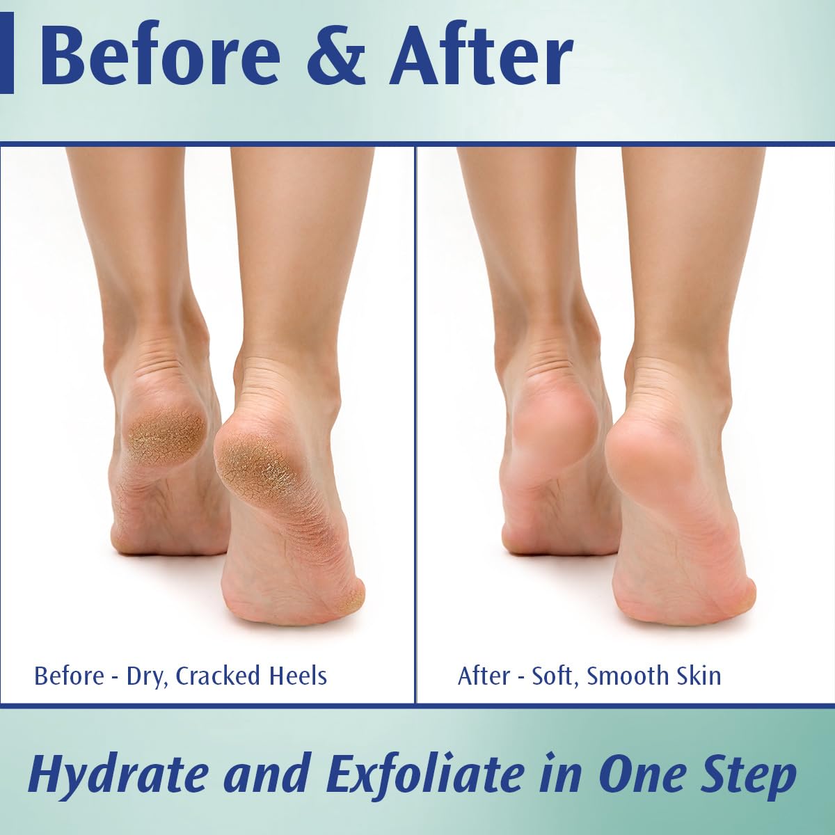 Pedifix cream texture close-up demonstrating smooth, rich formula for softening