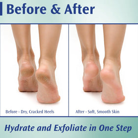 Pedifix cream texture close-up demonstrating smooth, rich formula for softening