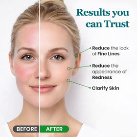 Peehss neck and decollete use showing gentle hydration ritual