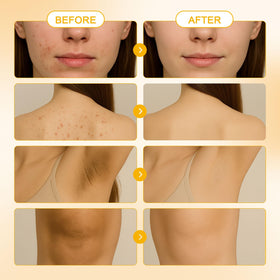 Peehss soft-bristle brush detail for gentle exfoliation and deeper cleansing