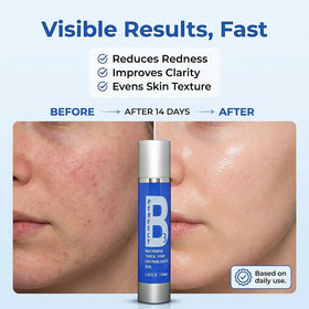Perfect B3 close-up texture dew on skin highlighting lightweight hydration