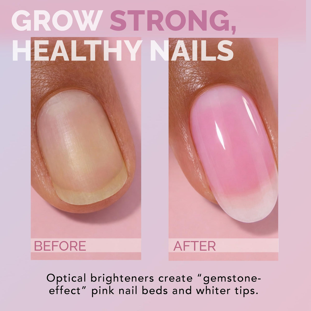 Perfect Formula before and after nails demonstrating reduced yellowing benefit