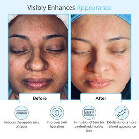 Perfect Image application brush with gel demonstrating controlled spread
