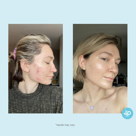 Perfect Image pad close-up texture highlighting gentle exfoliation benefit