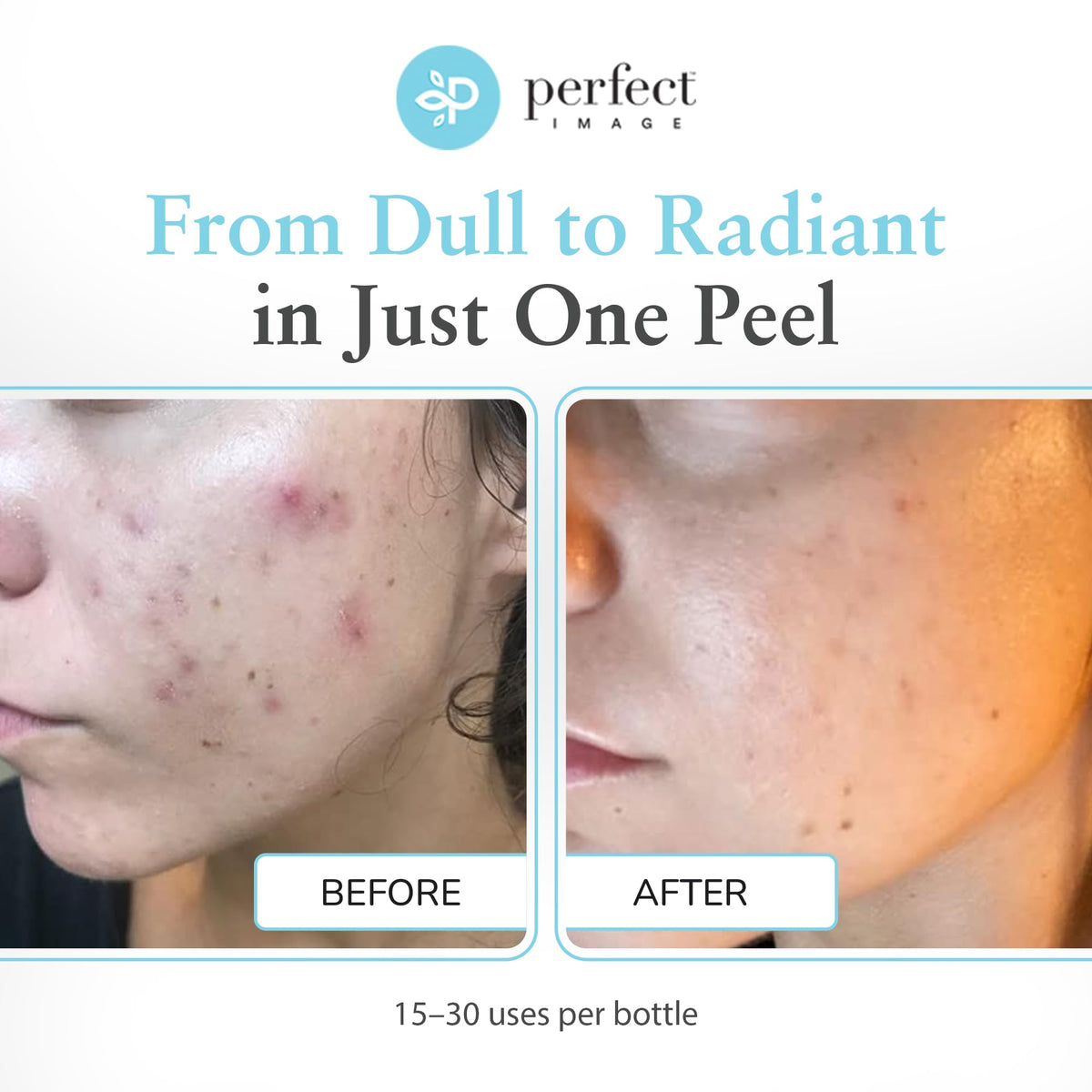 Perfect Image in-use clinic application demonstrating professional treatment and precise results